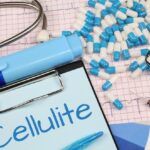 does keto diet get rid of cellulite