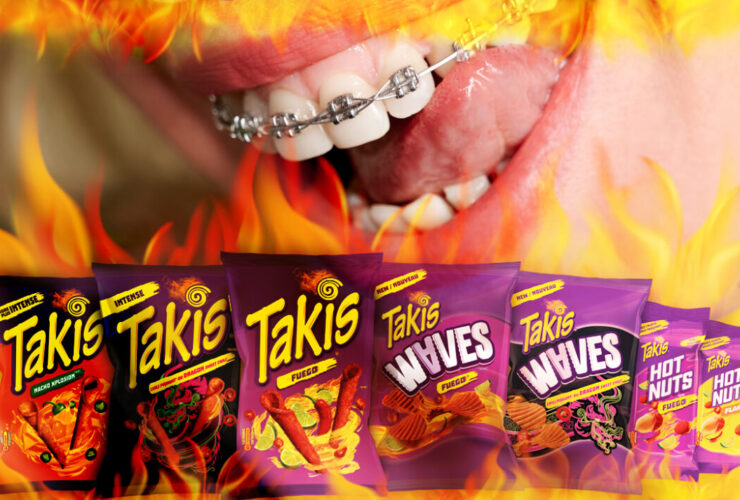can you eat takis with braces